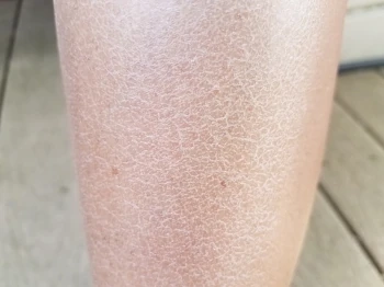 WINTER SKINCARE